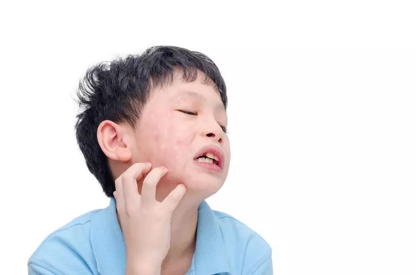 Как избежать аллергии у ребенка